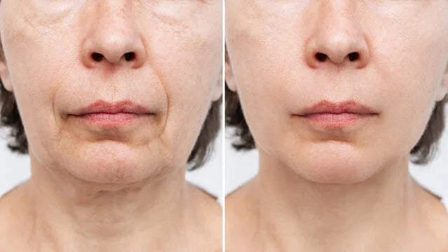 ReTime™ – Crema Antiarrugas con Ácido Hialurónico para Piel Firme y Radiante