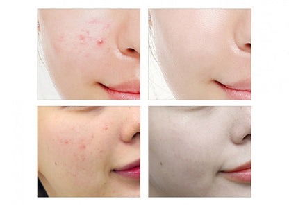 Ginseng® Serum Antioxidante Rejuvenescedor - 2X1 HOY! + ENVIO GRATIS