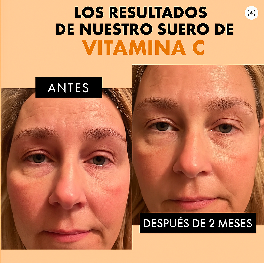 RadiantC Sérum Facial – ¡Llévate 2x1! Piel Más Joven + Envío Gratis + 49% DCTO