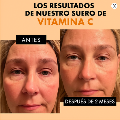 RadiantC Sérum Facial – ¡Llévate 2x1! Piel Más Joven + Envío Gratis + 49% DCTO