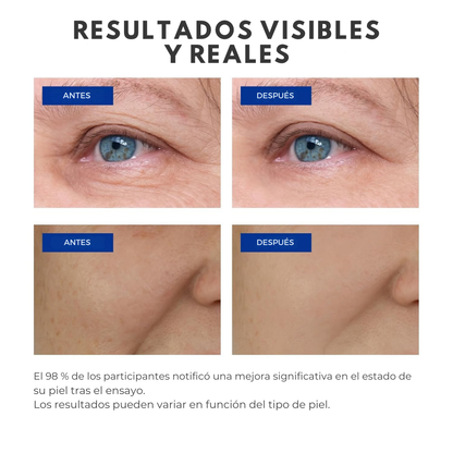 VitaGold - Crema Antiedad