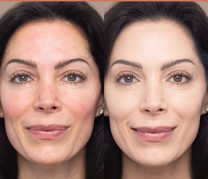 BASE LÍQUIDA CON VITAMINA C REJUVENESCEDOR + ENVÍO GRATIS + 49% DE DESCUENTO