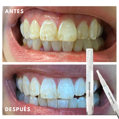 Smile White™ — El Lápiz Blanqueador 4X Más Potente