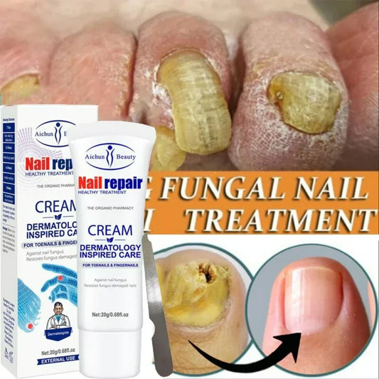 Nail repair - Anti Hongos Uñas Premium