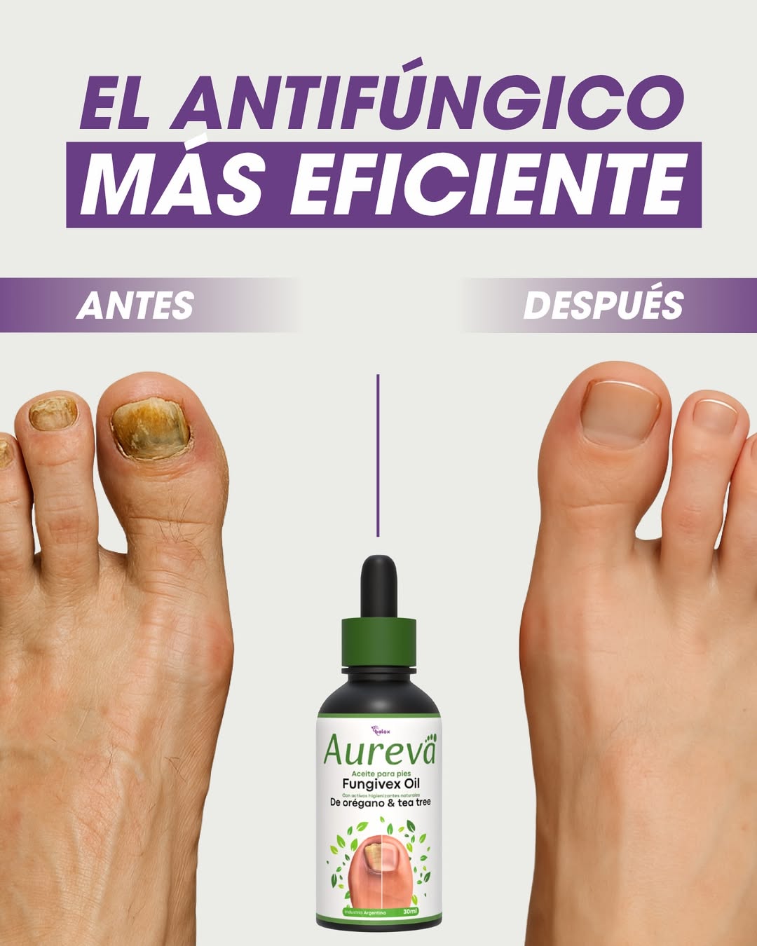Fungivex | Tratamiento eficaz que elimina el 99.9% de los hongos — ¡Oferta 2×1!