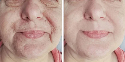 ReTime™ – Crema Antiarrugas con Ácido Hialurónico para Piel Firme y Radiante