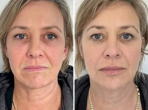 ReTime™ – Crema Antiarrugas con Ácido Hialurónico para Piel Firme y Radiante