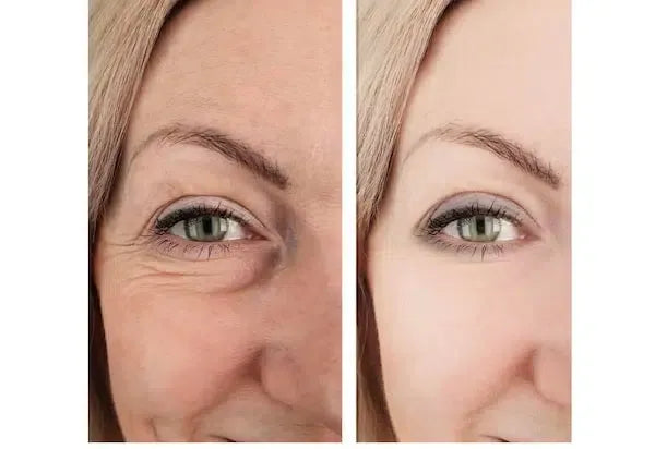 ReTime™ – Crema Antiarrugas con Ácido Hialurónico para Piel Firme y Radiante